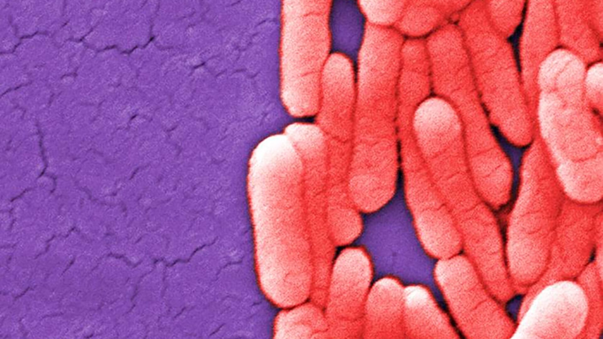 La salmonela se transmite a través alimentos contaminados como carne cruda, huevos y vegetales mal lavados (U.S. Centers for Disease Control and Prevention)