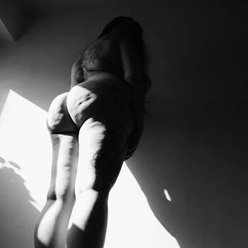 Ana eligió fotografiar celulitis. Sostiene