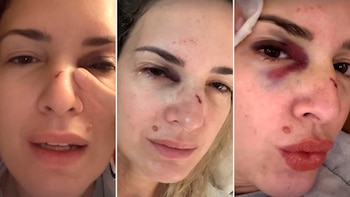 Inicialmente, el rostro de la