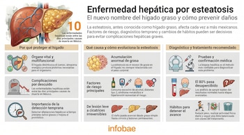 Infografía ilustra la enfermedad hepática por esteatosis con imágenes de hígado sano y graso, factores de riesgo, evolución, diagnóstico y tratamientos.