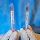 Colombianos incrementaron las búsquedas sobre el hantavirus en Google: indagan sobre síntomas y la presencia del virus en el país
