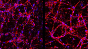 Imagen microscópica en dos paneles de fondo oscuro. Muestra numerosas células con núcleos azules y estructuras filamentosas interconectadas de color rojo