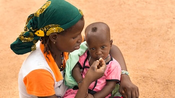 Unicef alertó que por la pandemia diez millones de niños en África sufrirán desnutrición aguda en 2021