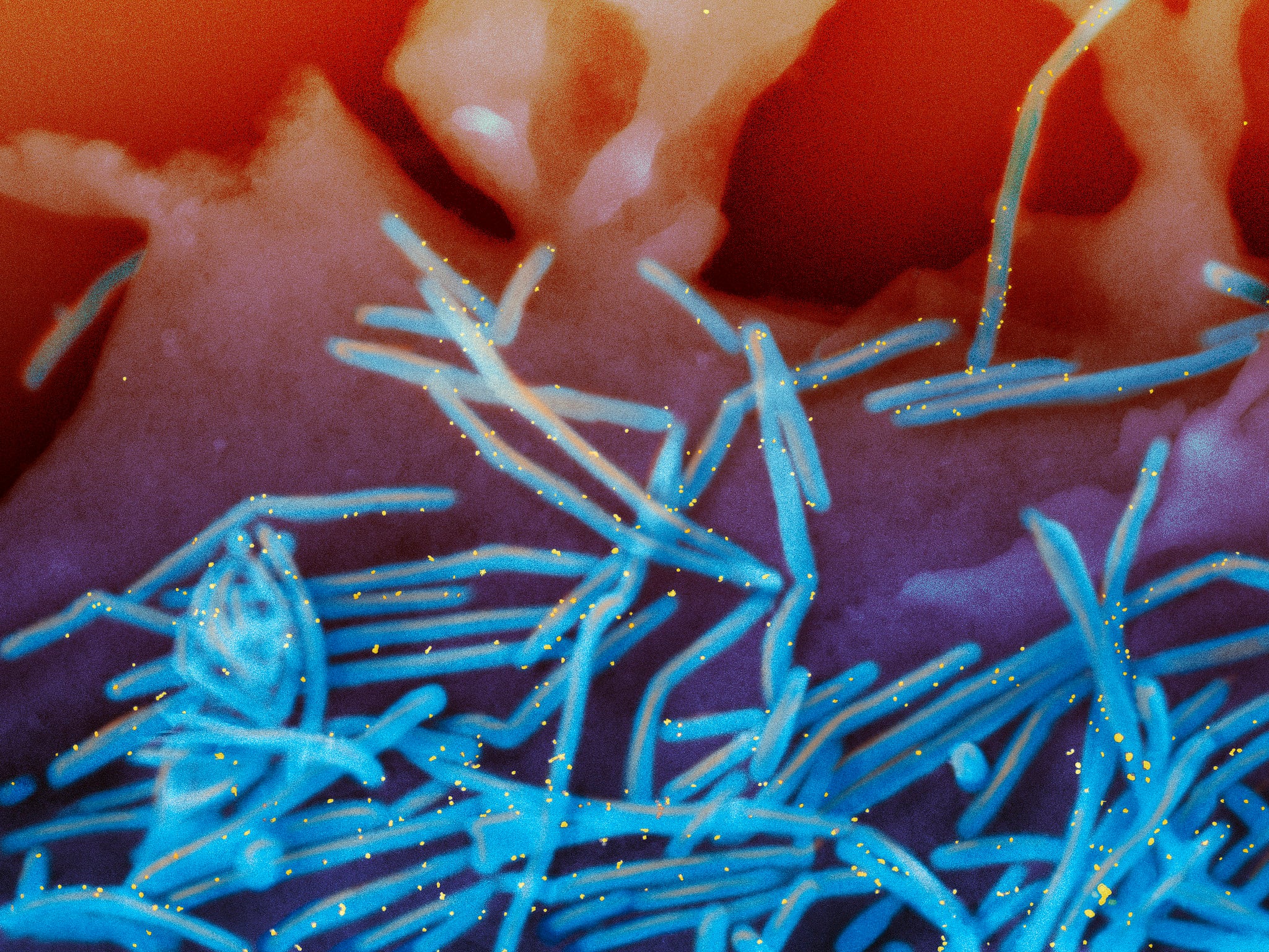 El virus que puede provocar hospitalizaciones en bebés y que muchas familias aún desconocen