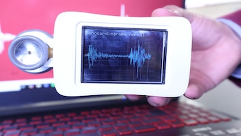 El Estetoscopio digital desarrollado por