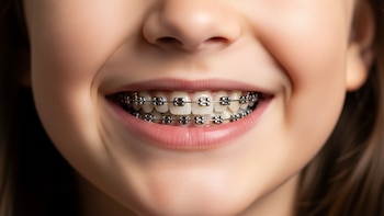 Cómo la evolución de la mandíbula explica el uso de brackets