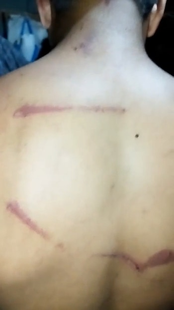 Brutal golpiza a un adolescente de 16 años en Salta