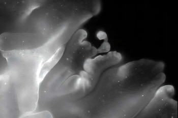 Imágenes de alto aumento de