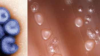 El orden de infección determina la respuesta inmunitaria frente a bacterias o virus, según una investigación