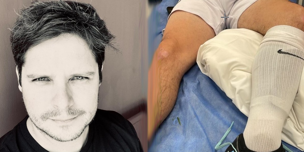 Gian Piero Díaz sufre Grave lesión y anuncia cirugía inminente: “A ponerle ganas y tratar de caminar” - Infobae