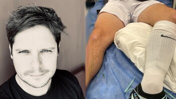 Gian Piero Díaz sufre grave