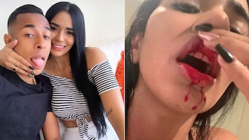 Una de las fotografías donde se ve a Cortes con sangre en la boca