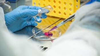 Más de 400 trasplantes de células madre hematopoyéticas se han realizado hasta el momento en Panamá