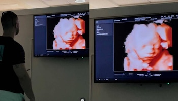 Matteo Tulini anuncia que será