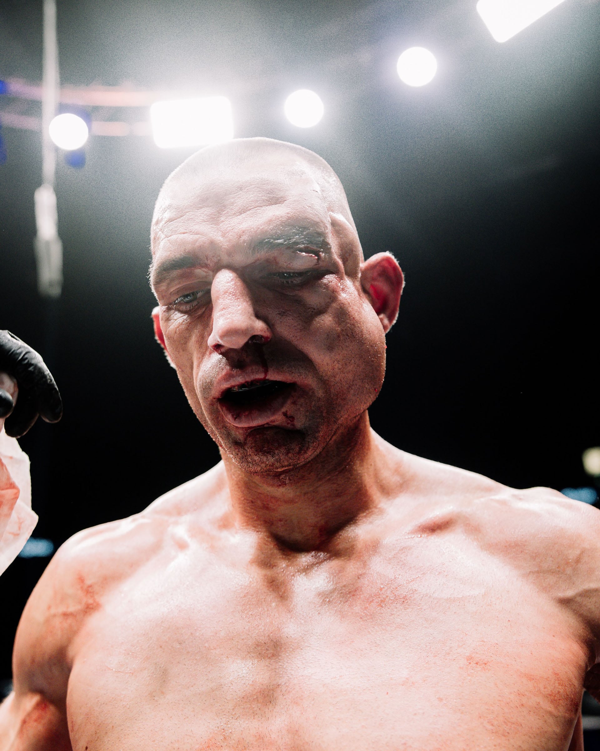El luchador abandonó el ring con el rostro totalmente desfigurado