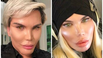 Cirugías, bullying y abuso sexual: