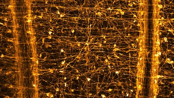 Nematostella vectensis regula su sueño