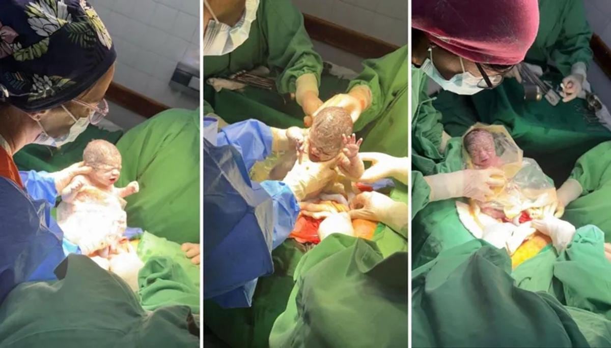 En Salta nacieron trigemelas monocoriales triamnióticas un evento que ocurre solo una vez cada un millón de embarazos en el mundo (Gob de Salta)