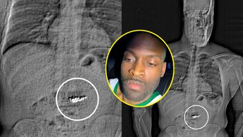 El robo ocurrió en el