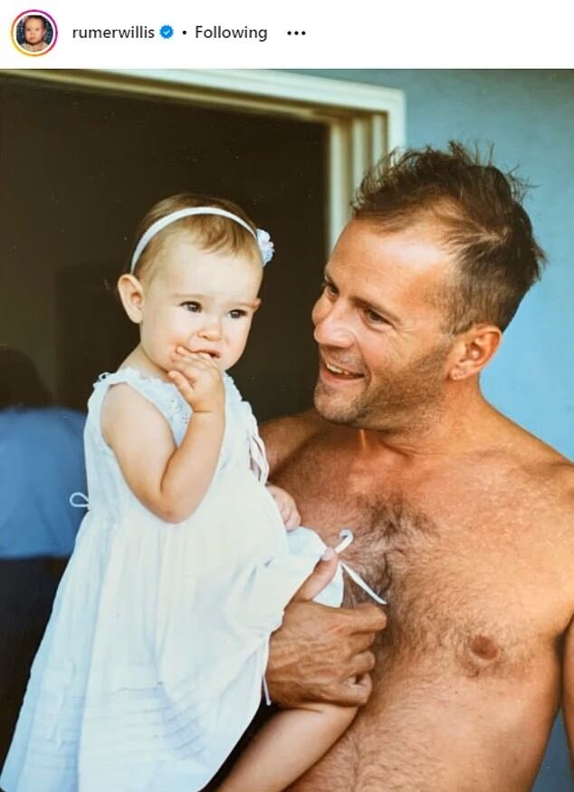 El actor, con una fortuna estimada en 250 millones de dólares, ya no puede administrar sus finanzas debido al progreso de la demencia frontotemporal.