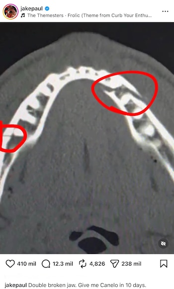 (Captura de pantalla)