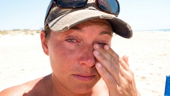 Remedios caseros para la irritación de ojos por el sol