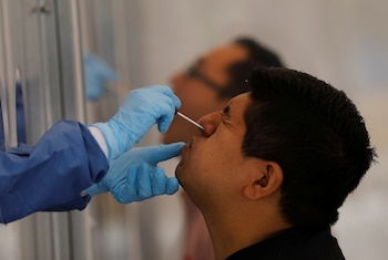 La enfermedad de COVID-19 en