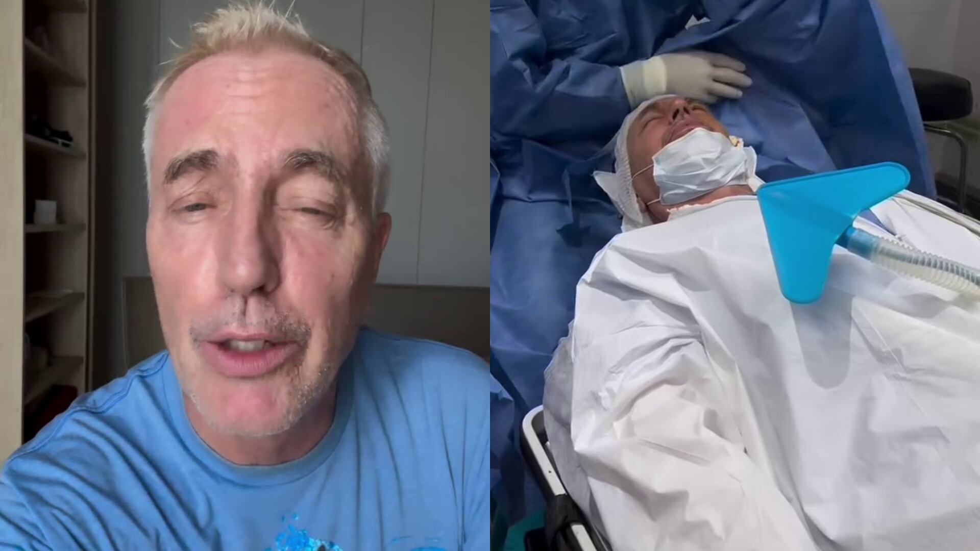 Marley mostró el detrás de escena de su operación de ojos