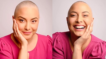 A sus 35 años, Natalia Salas fue diagnosticada con cáncer de mama en el 2022.