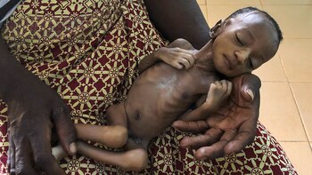 El hambre está aumentando debido