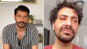 El actor Guillermo Collard denunció