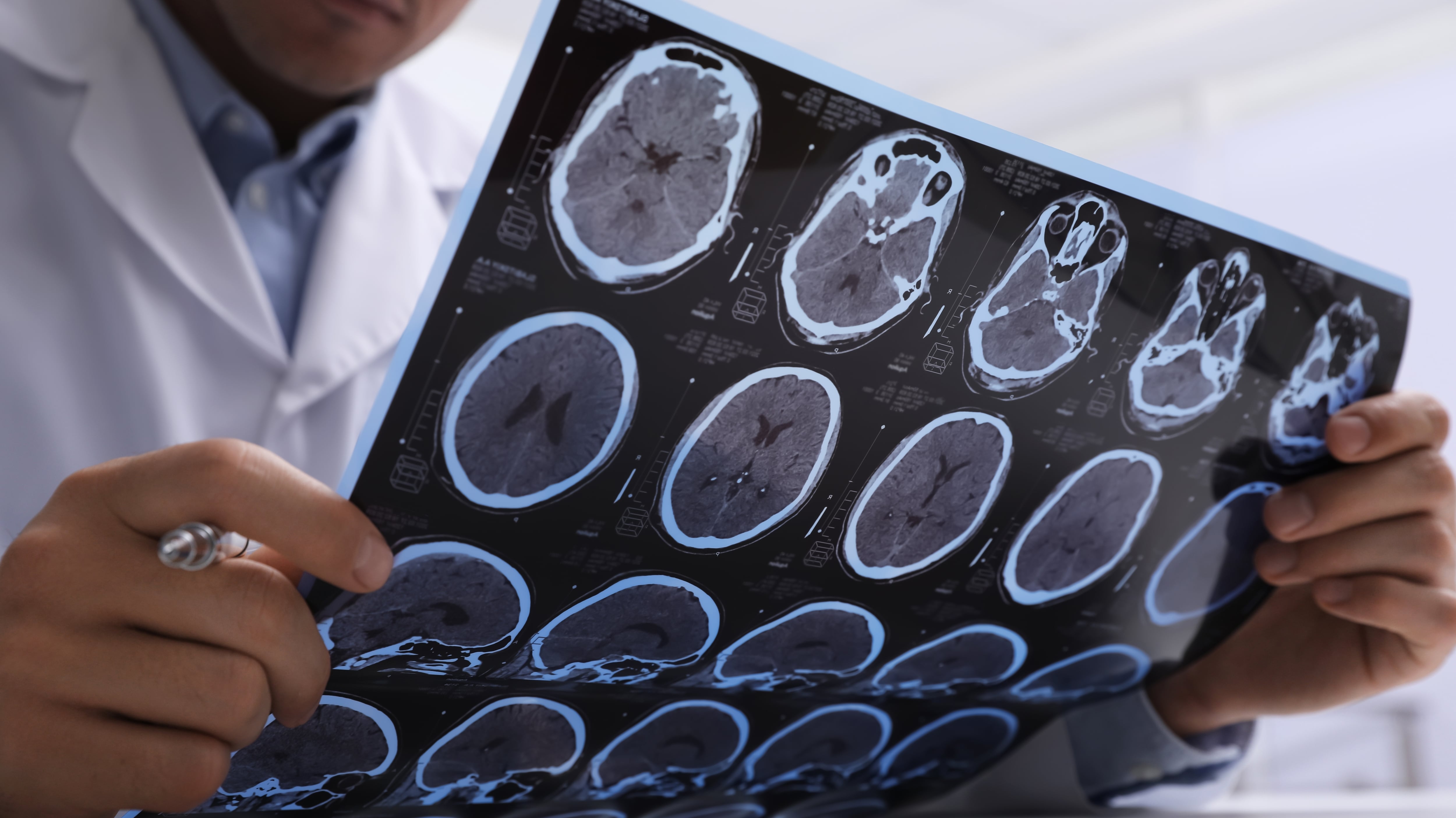 Un especialista observando imágenes de rayos X del cerebro (Shutterstock)