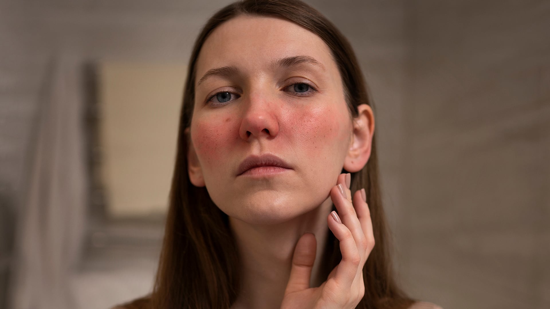 El enrojecimiento facial persistente puede indicar rosácea, una afección crónica que requiere diagnóstico y tratamiento dermatológico especializado (Freepik)