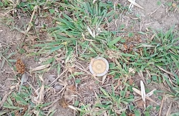 El niño se tragó la moneda mientras jugaba con una alcancía en la casa de su abuela, su madre advirtió que había cambiado de color y salió a la calle a pedir auxilio (Fotos: La Capital)