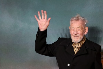 El reconocido actor británico sufrió