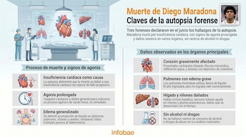 Infografía forense sobre la muerte de Diego Maradona con su foto. Se observan médicos, un cuerpo en camilla y diagramas de corazón, pulmones, hígado y riñones detallando los hallazgos.