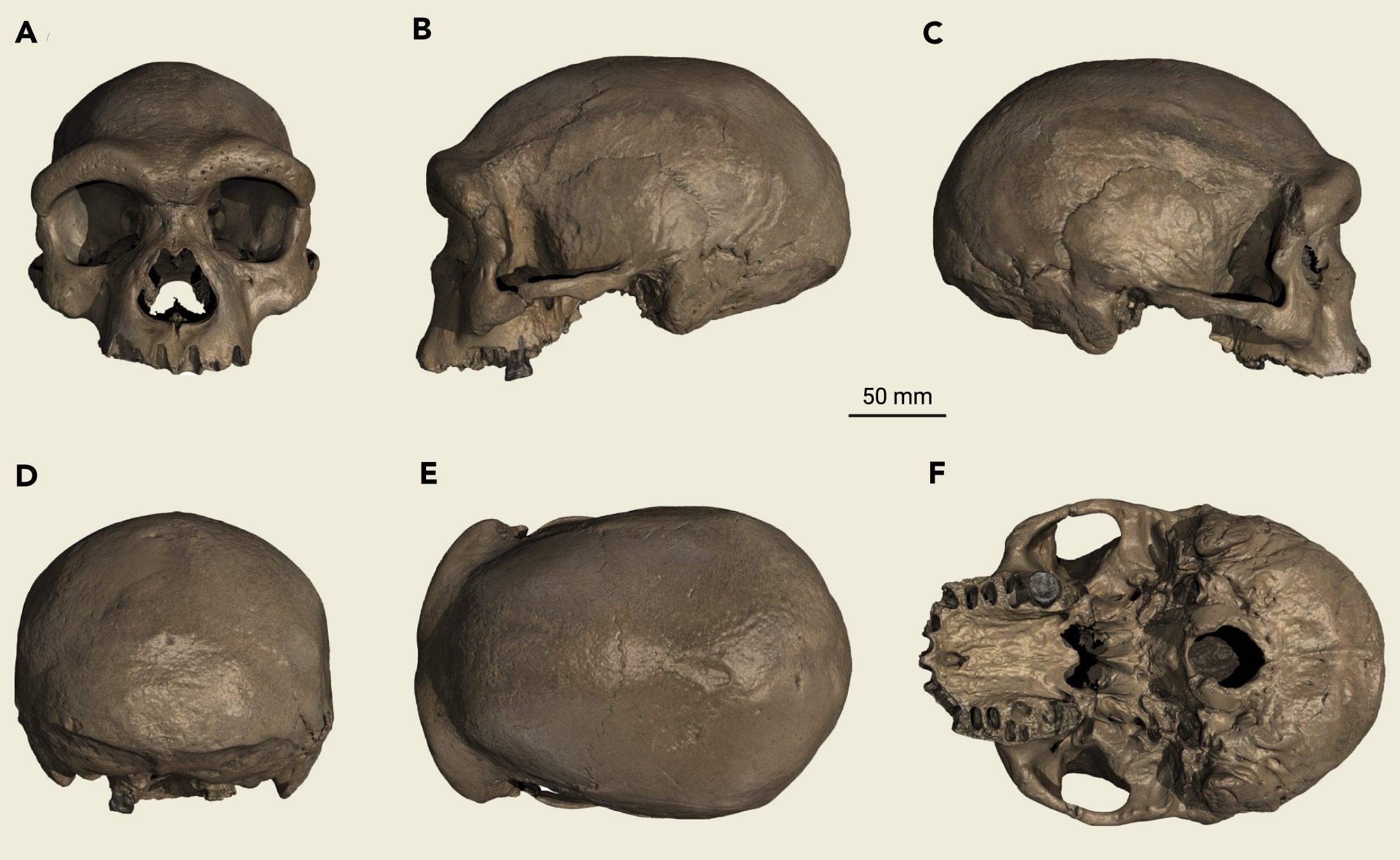Los científicos identificaron la especie Homo longi a partir del cráneo fósil descubierto en Harbin (Gentileza, estudio: Un cráneo de gran tamaño hallado en Harbin, en el noreste de China, establece un nuevo linaje humano del Pleistoceno Medio, publicado en The Innovation)