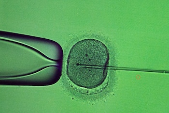 Un especialista efectúa un procedimiento