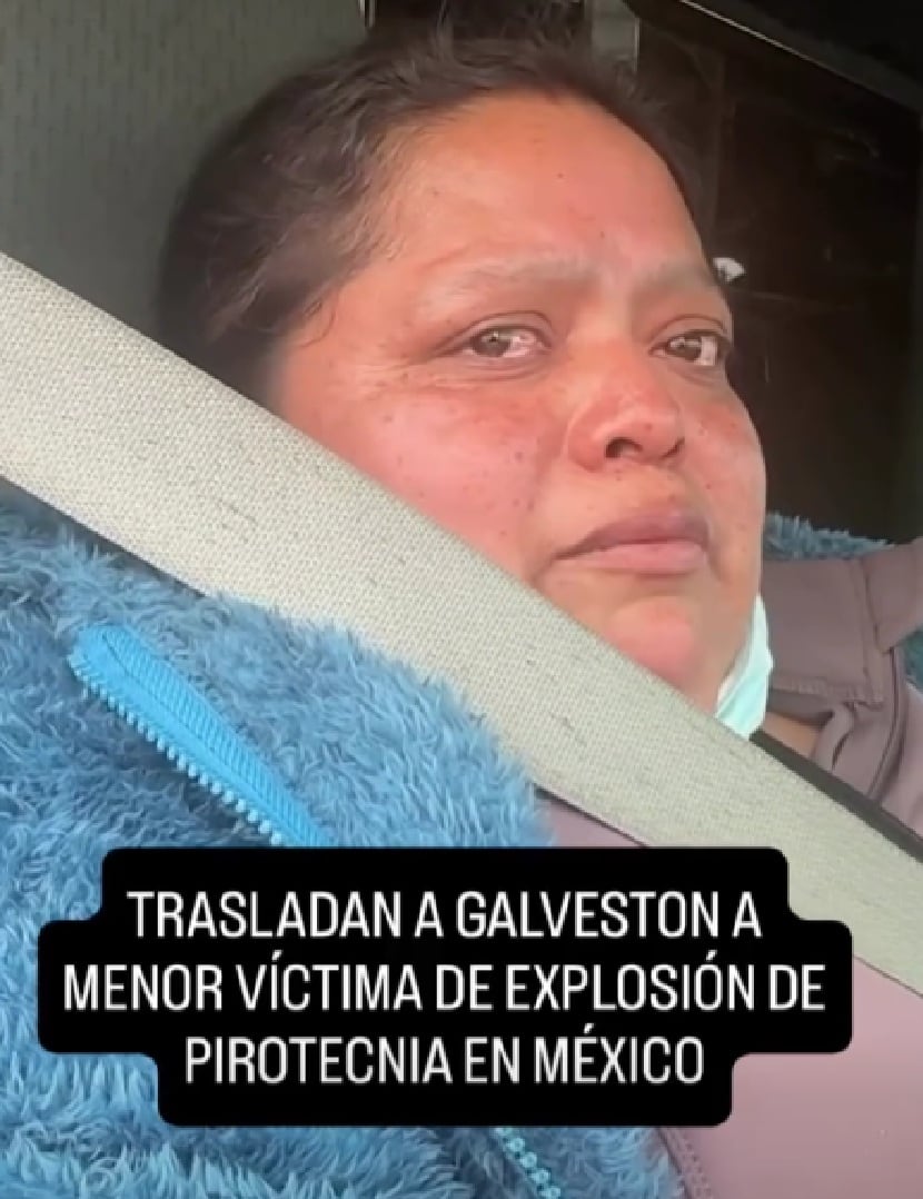 Familiar menor trasladada a EU por quemaduras Santa María Canchesdá, Temascalcingo Edomex