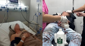 Dos fotografías de un paciente en una camilla hospitalaria y personal con guantes que asiste a una persona con sangre en el pantalón
