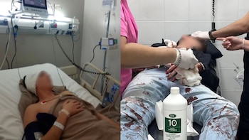 Denunciaron una brutal golpiza por homofobia contra una pareja en Tucumán: uno de ellos está en terapia intensiva