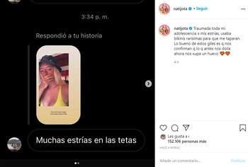 Nati Jota le contestó a un seguidor que le criticó las estrías
