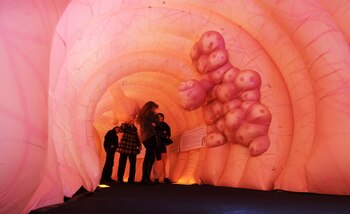 Factores ambientales y genéticos se investigan para explicar el aumento de cáncer colorrectal en jóvenes en economÃas desarrolladas y emergentes (Foto: Christian Charisius/dpa)