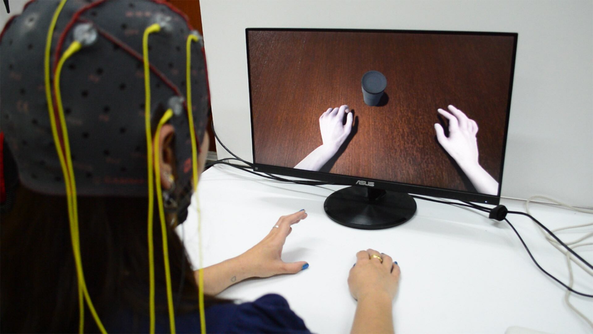 Investigadores de la Argentina desarrollaron un sistema innovador para la rehabilitación motora tras un ACV mediante tecnología cerebro-computadora (UNER)