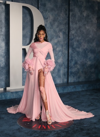 El activismo de Winnie Harlow