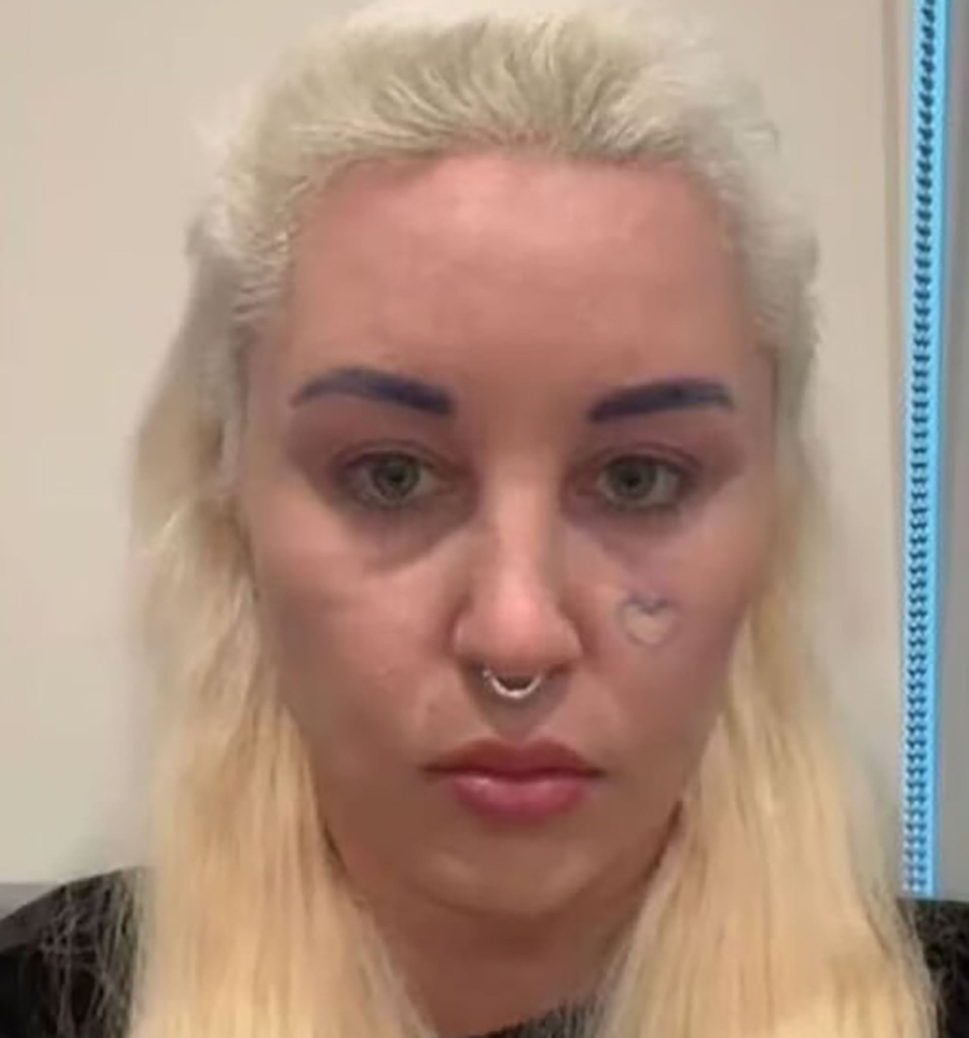 Luego de esta serie de sucesos que cambiaron su vida, Amanda fue diagnosticada con trastorno bipolar y esquizofrenia (Instagram)