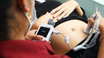 Gestantes deben cumplir seis controles prenatales mínimos: Los síntomas que no deben ignorar, según el Minsa