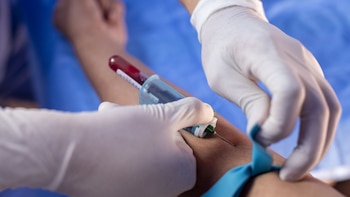 El control regular de la