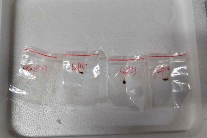 Los patógenos vegetales tóxicos que un científico chino introdujo en los Estados Unidos el año pasado escondidos en su mochila, según informaron las autoridades federales (Tribunal de Distrito de los Estados Unidos para el Distrito Este de Michigan a través de AP)