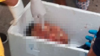 La cabeza de la víctima